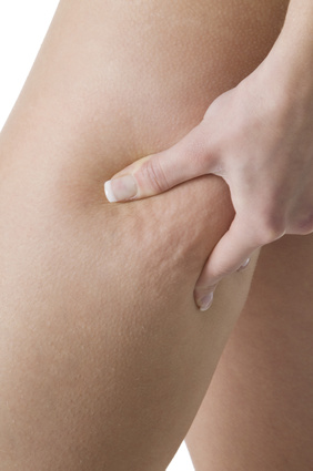 cellulite cellulite